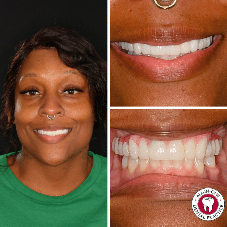 A woman with medium-dark skin and a nose ring smiles, showing her teeth. Close-ups to the right highlight her white, even teeth. The bottom right corner shows an “All-In-One Dental Practice” logo.