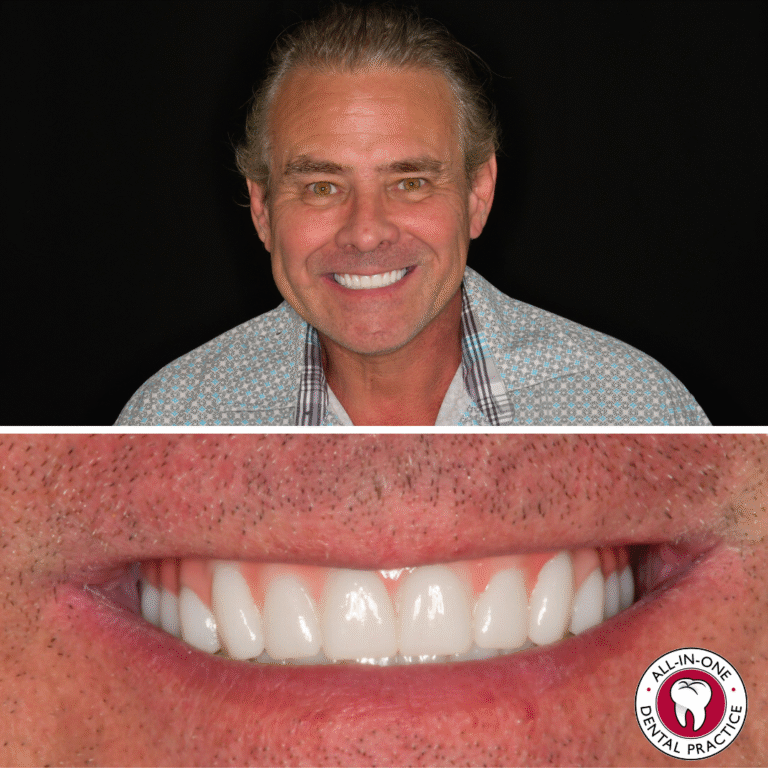 A smiling middle-aged man with graying hair is shown above a close-up of his bright, even teeth. The image features a logo reading “All-in-One Dental Practice” in the lower right corner.