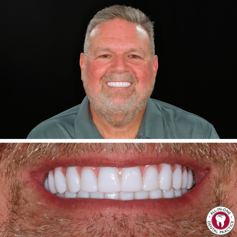 A smiling middle-aged man with short gray hair is shown above a close-up of his bright white teeth. Both images have a black background, and a dental clinic logo appears in the bottom right corner.