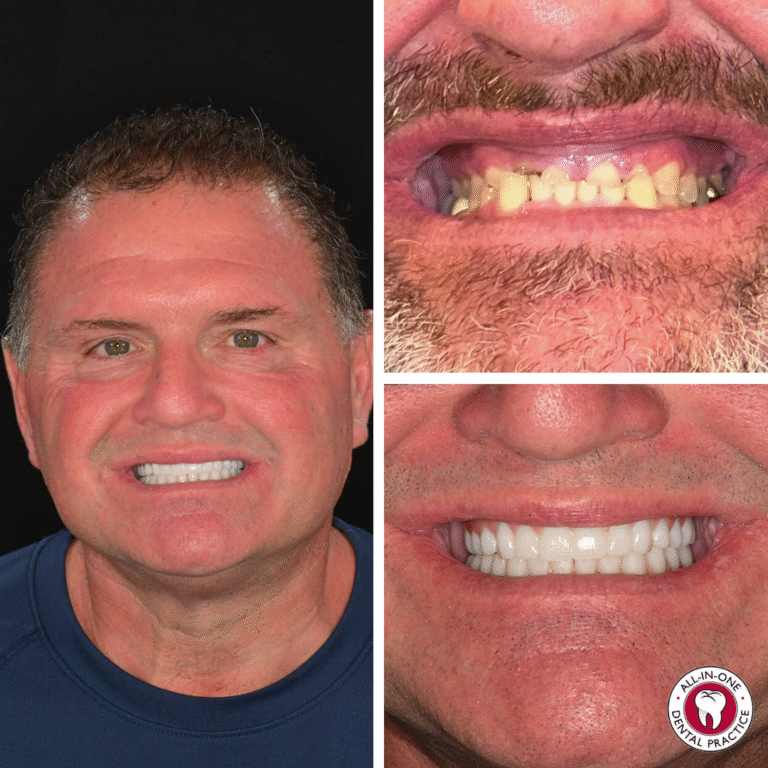 A smiling man shows his teeth. On the right, two close-ups compare his original yellowed, uneven teeth above and bright, straight teeth after dental treatment below. A circular dental clinic logo is in the lower right corner.