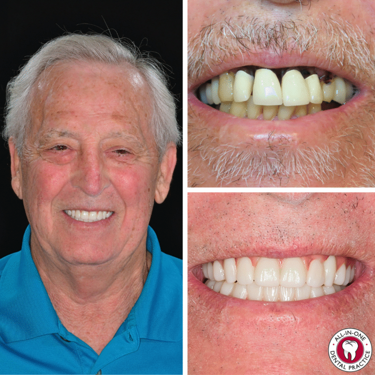 A smiling older man in a teal shirt is shown. Beside him, close-up photos show his teeth before—discolored and uneven—and after white and straight dental work. A dental clinic logo appears at the bottom right corner.