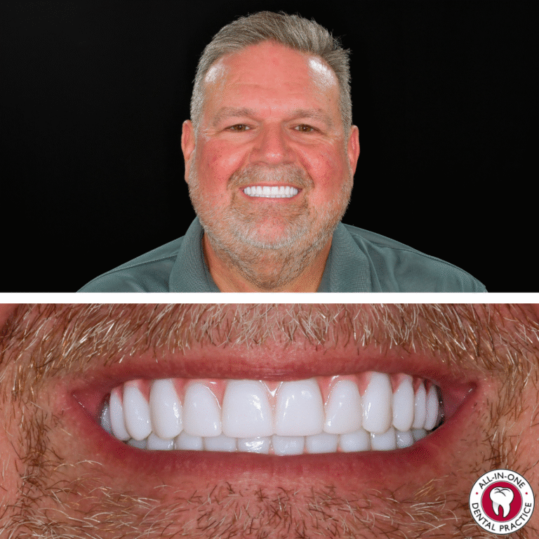 A smiling middle-aged man with short gray hair is shown above a close-up of his bright, straight teeth. The bottom right corner features the All-In-One Dental Place logo.