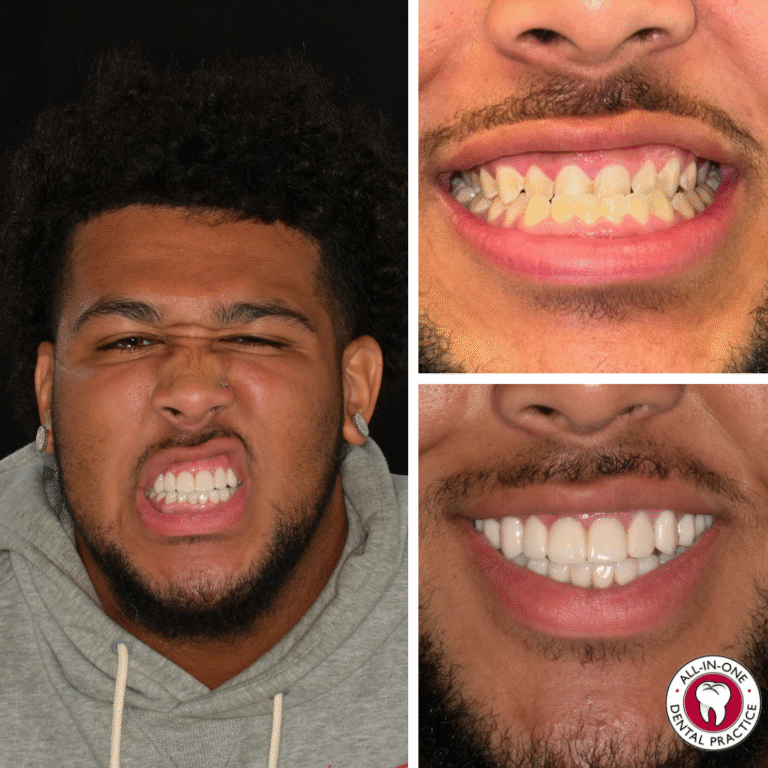 A man baring his teeth is on the left; two images to the right show close-ups of his teeth, first crooked and yellowed, then straight and white after dental work. A dentist office logo appears in the lower right corner.