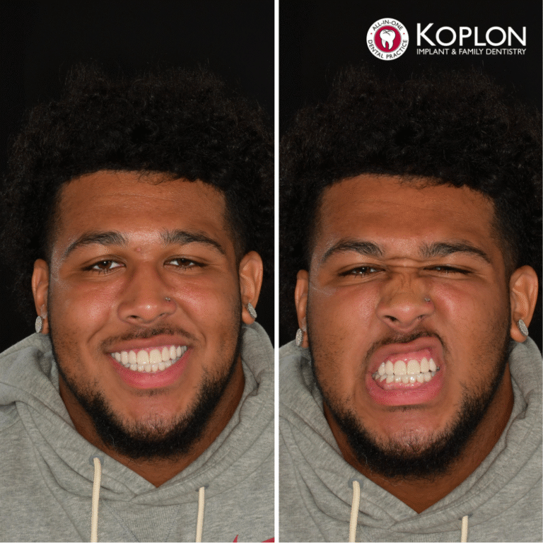 Side-by-side photos of a man with curly hair and a short beard, wearing a gray hoodie, smiling in the left image and making a scrunched, teeth-baring face in the right. "Koplon Implant Family Dentistry" logo is at the top right.
