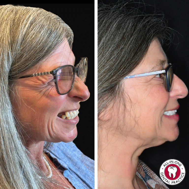 Side-by-side photos show an older woman with gray hair and glasses, smiling. Left: crooked, yellowed teeth with receding gums. Right: straight, white teeth and healthy gums. The logo reads “All-in-One Dental Practice.”.