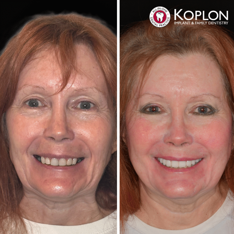 Side-by-side photos of a smiling woman before and after dental work; on the right, her teeth look whiter and more even. Logo is in the top right.