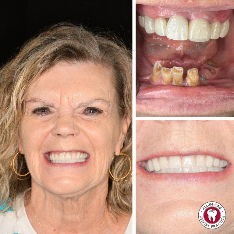 A smiling woman shows off her new teeth, with close-ups of her upper and lower teeth before and after treatment. Logo bottom right.